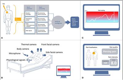 “What About Automated Pain Recognition for Routine Clinical Use?” A Survey of Physicians and Nursing Staff on Expectations, Requirements, and Acceptance